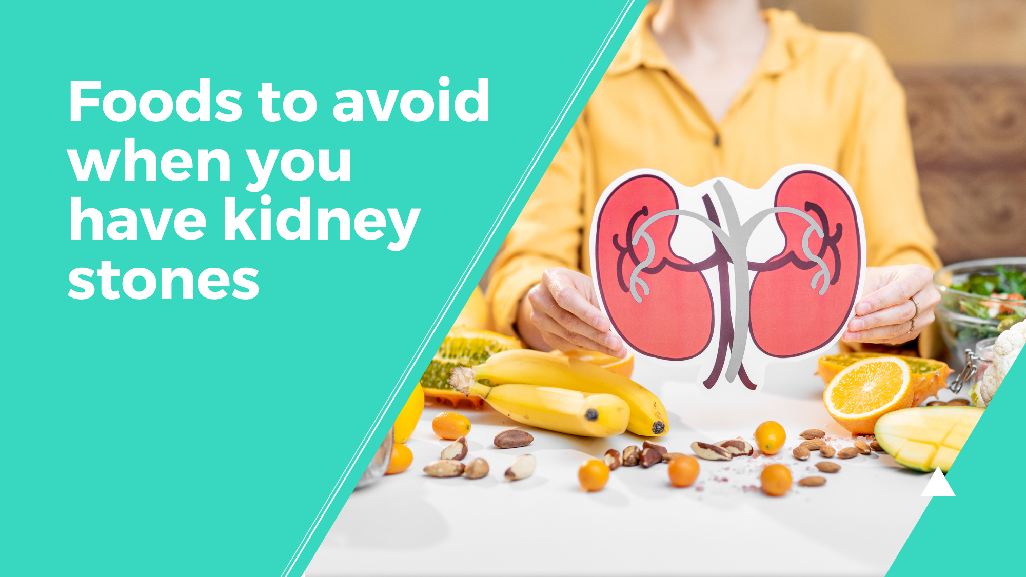 Foods to avoid when you have kidney stones